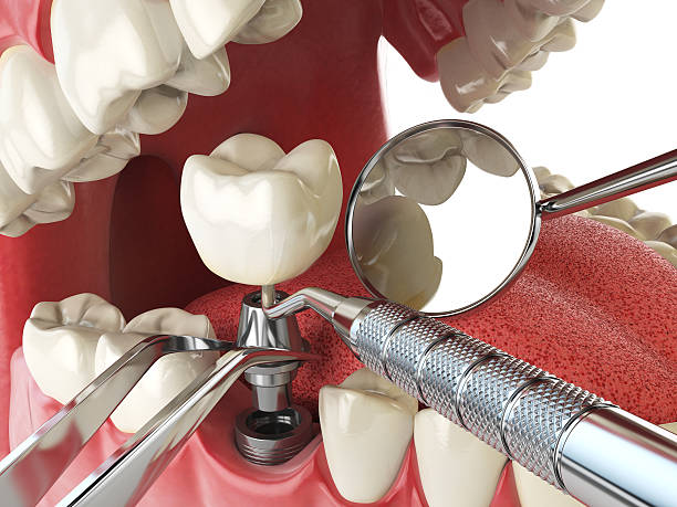Best Broken or Cracked Tooth Emergency Dentist in Fairport Harbor, OH